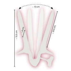 Vaginal Speculum
