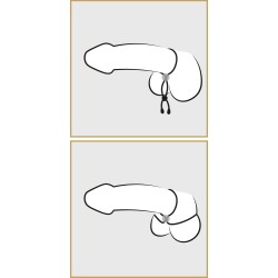 BK cock & ball loop