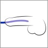 Silicone Dilator 3pcs Set
