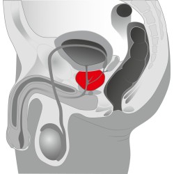 Prostate Massager